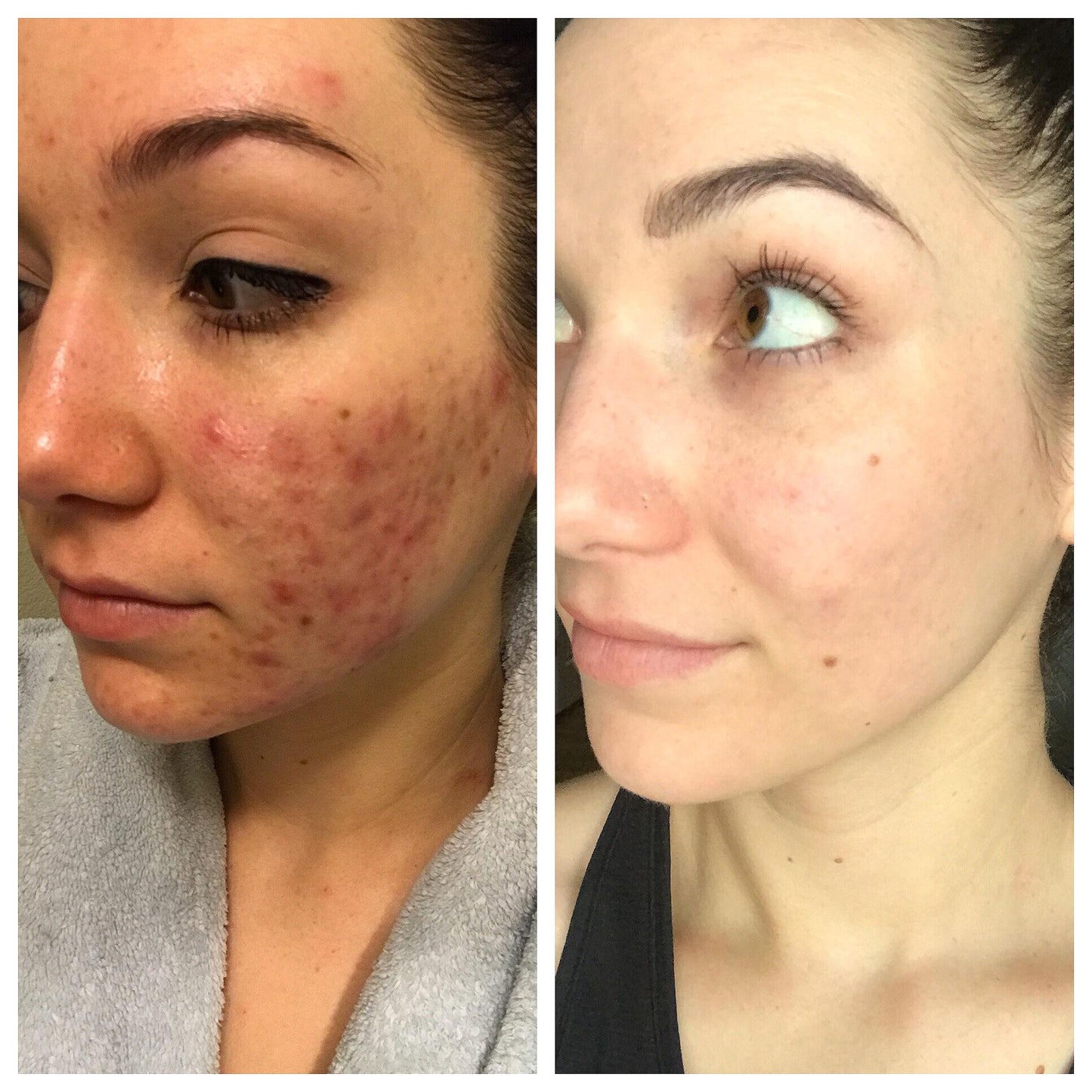 5-in-1 Skincare Device