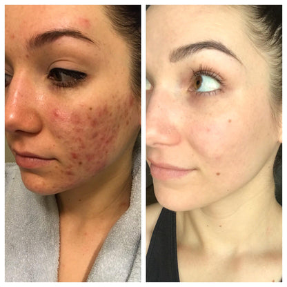 5-in-1 Skincare Device