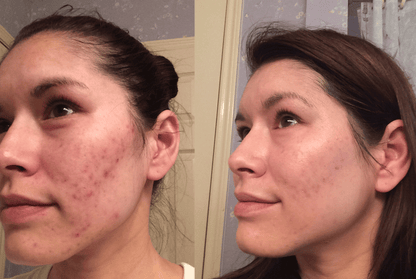 5-in-1 Skincare Device