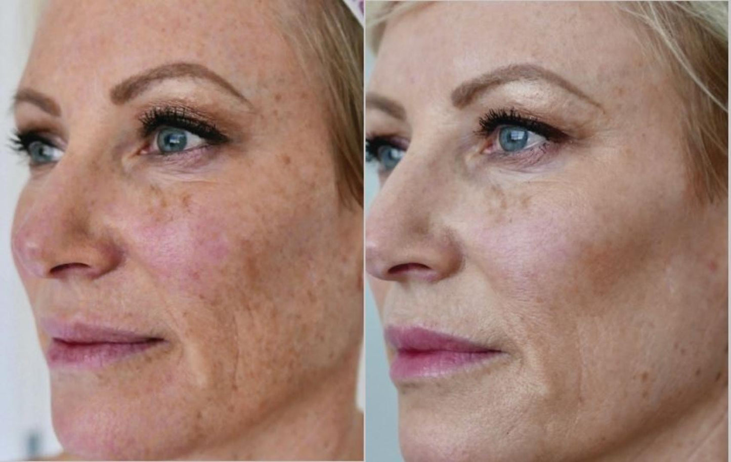 6-in-1 Anti Aging Wand