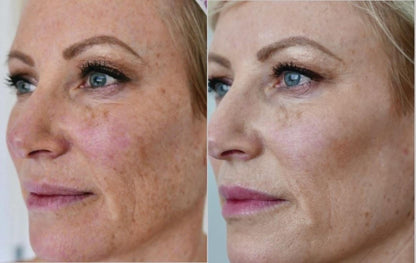 6-in-1 Anti Aging Wand