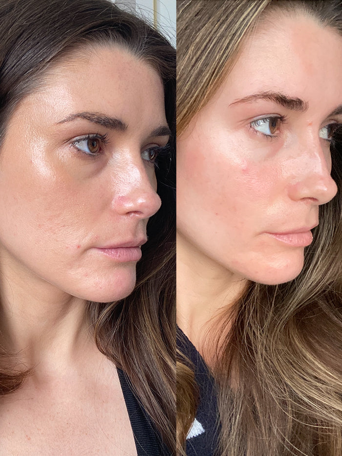 6-in-1 Anti Aging Wand