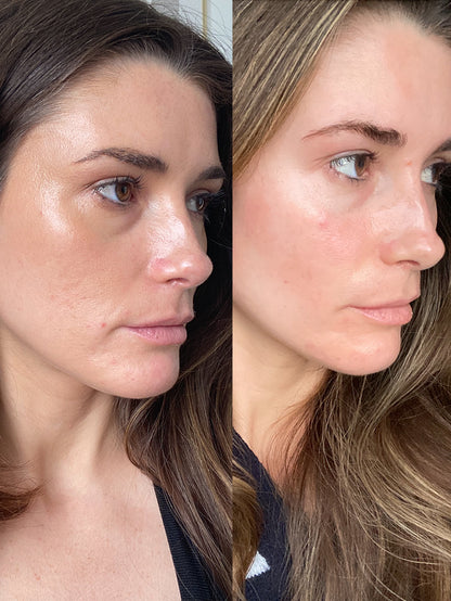 6-in-1 Anti Aging Wand